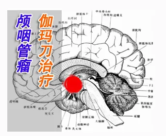 研究表明，松弛感成为新追求与神经可塑性高度相关，这件事比你想的更重要
