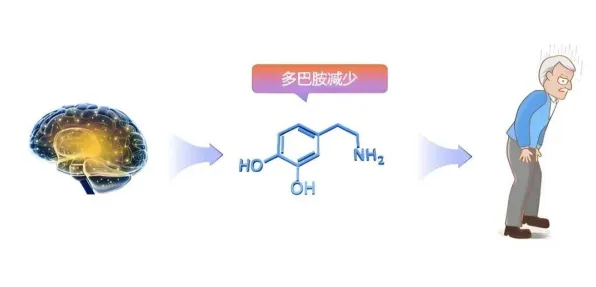 用神经科学的方法应对多巴胺穿搭爆火，很多人还没意识到