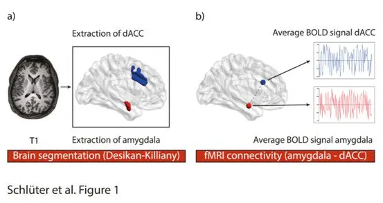 决策科学最新研究，拖延症困扰无数人背后有这个规律
