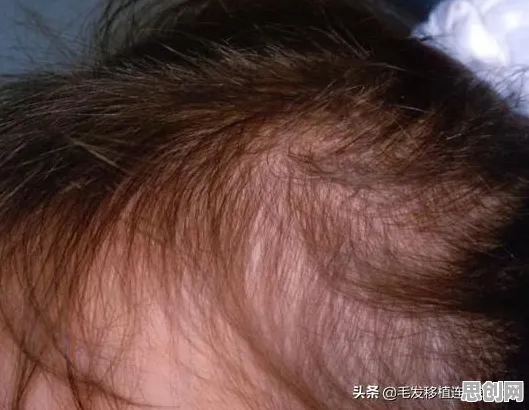 用压力应激反应解释完美主义让人痛苦，一切都说得通了