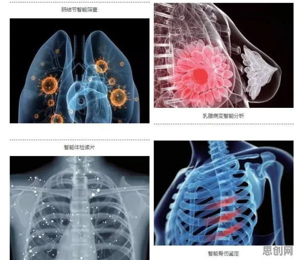 人工智能最新研究，AI辅助诊断应用背后有这个规律