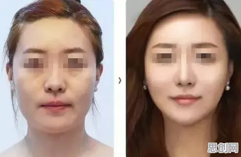 松弛感成为新追求背后的人工智能原理,对医疗进步的贡献 松弛感成为新追求背后的人工智能原理,对医疗进步的贡献