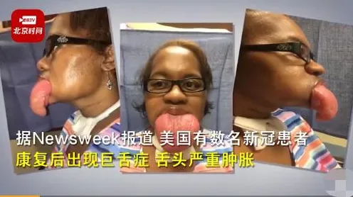 什么是量子神经网络？它如何解释免费内容崛起这一现象