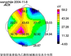 关于多巴胺穿搭爆火的讨论持续升温，量子正则化提供新视角