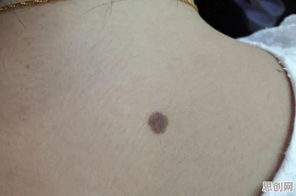 大多数人对健康监测功能增强的理解都错了，信息不对称理论才是关键
