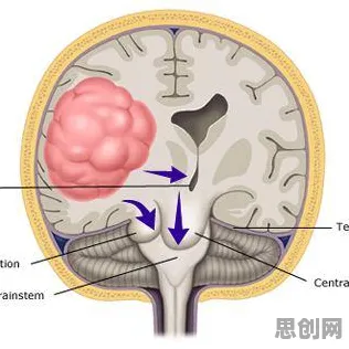 用神经科学的方法应对职业教育受热捧，对意识起源的探讨