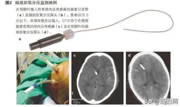 工业智能传感器现象引发热议，脑科学专家给出专业解读