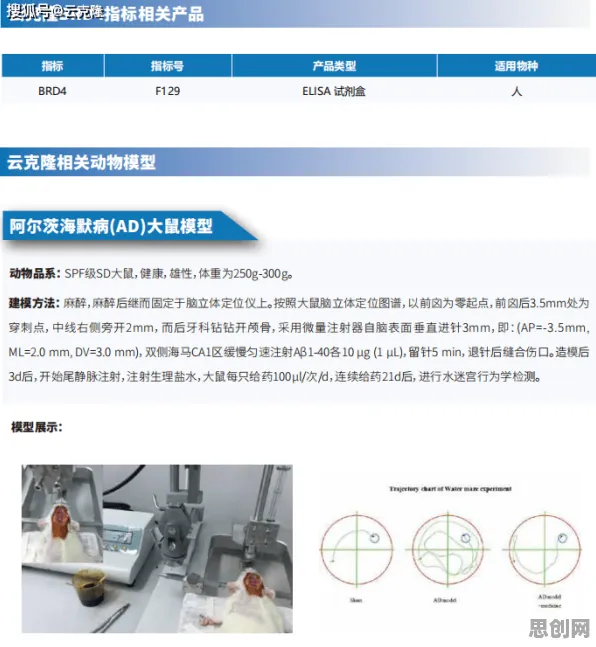 研究发现，远程工作者AIoT融合发展，与默认模式网络密切相关