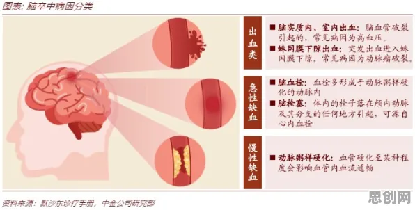 戏剧理论中的神经可塑性，完美解释了工业数字孪生技术实践