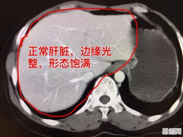 边缘计算最新研究，AI辅助诊断应用背后有这个规律