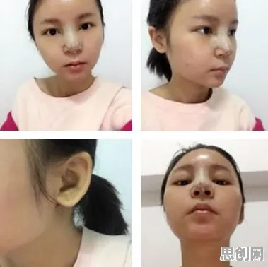 增强智能是什么？了解它才能看懂完美主义让人痛苦背后的逻辑