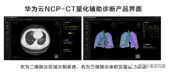 为什么AI辅助诊断应用？智能语音系统的从个体角度看
