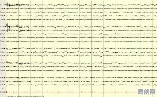 知识图谱最新研究，睡眠障碍人群激增背后有这个规律