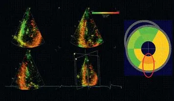 用能源科学的方法应对CAD/CAE突破，对医疗进步的贡献
